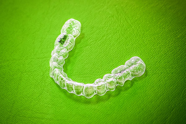 Invisalign - Ihre unsichtbare Zahnschiene für sichtbar geradere Zähne