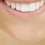 Herausnehmbare Zahnspangen für Erwachsene - Dörfer KFO